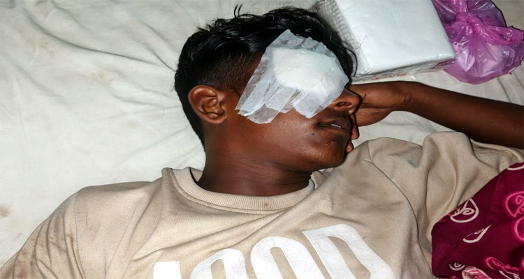 সন্ত্রাসী হামলায় চোখ হারানোর শঙ্কায় পিকআপ চালক