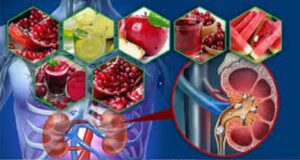 কিডনিতে পাথর হলে খাদ্যাভাসে যেসব পরিবর্তন জরুরি