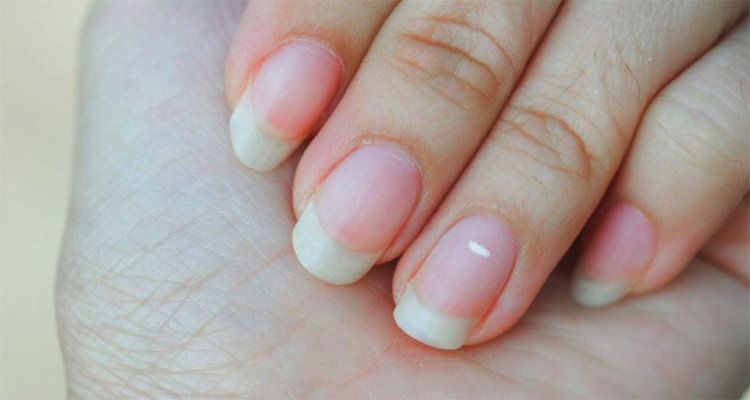 নখের এই ৫ লক্ষণ দেখলে অবহেলা করবেন না