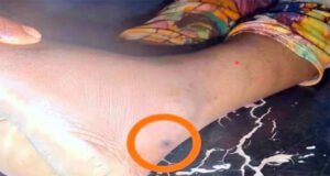 লাখাইয়ে সাপের কামড়ে কিশোরীর মৃত্যু, আতঙ্ক